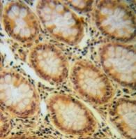 IGF-I R/IGF1R [p Tyr1165, p Tyr1166] Antibody