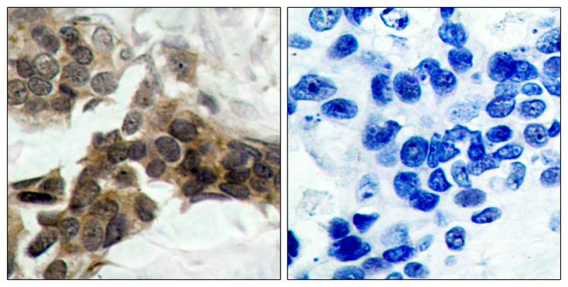 IkB-alpha [p Ser32, p Ser36] Antibody - BSA Free