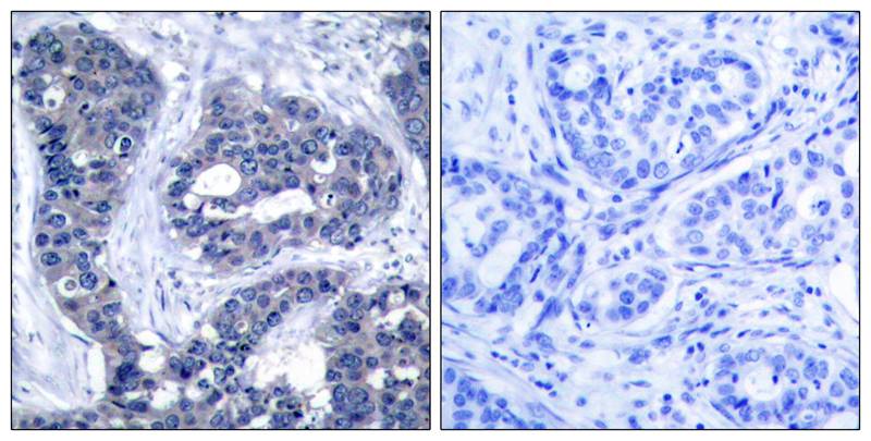 IRS1 [p Ser639] Antibody - BSA Free