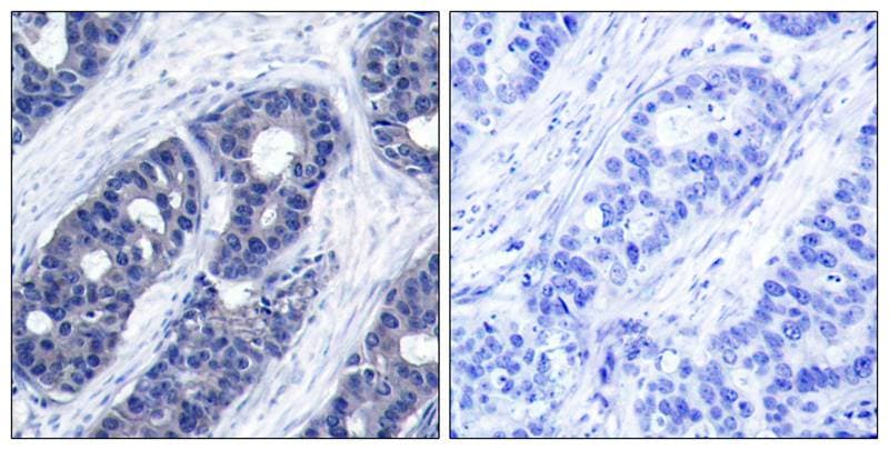 IRS1 Antibody - BSA Free