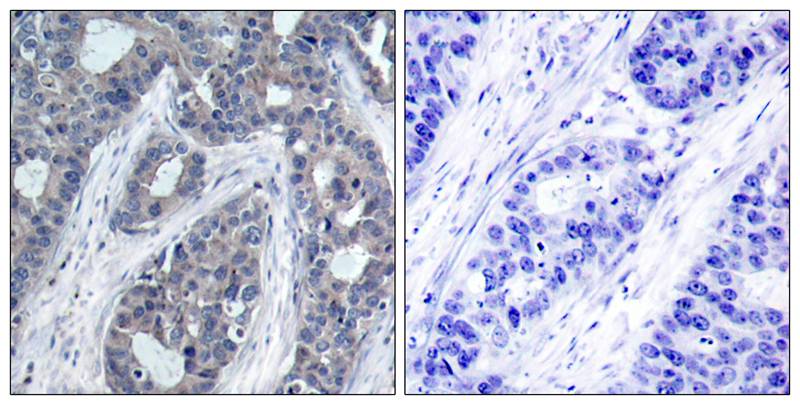 IRS1 [p Ser636] Antibody - BSA Free