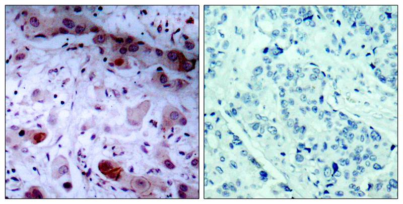 Jak1 [p Tyr1022] Antibody