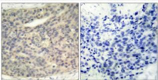 LIM Kinase 1 [p Thr508] Antibody