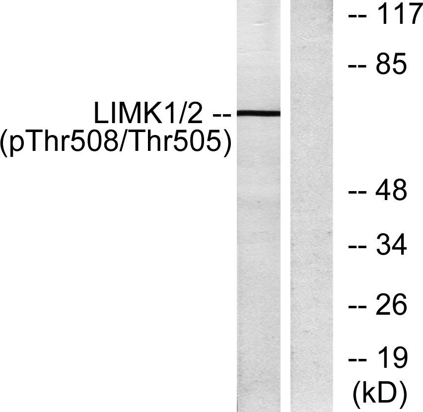 LIM Kinase 1 [p Thr508] Antibody