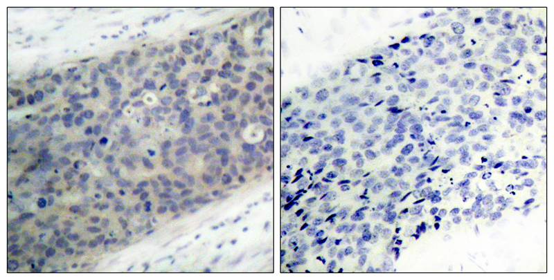 LIM kinase 2 [p Thr505] Antibody