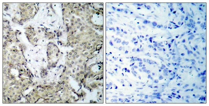 MKK3/MEK3 [p Ser189] Antibody - BSA Free