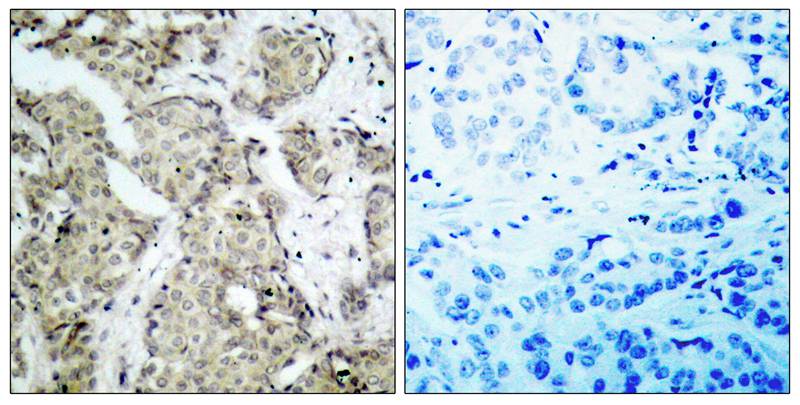 MKK6/MEK6 [p Ser207] Antibody