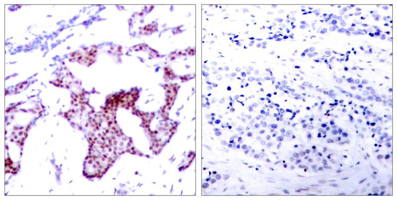 RelA/NFkB p65 [p Ser276] Antibody