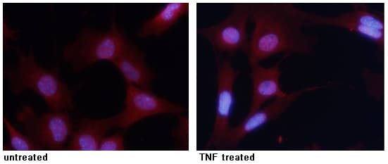 RelA/NFkB p65 [p Ser276] Antibody