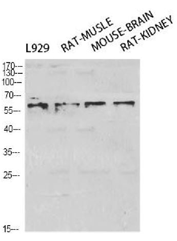 RelA/NFkB p65 [p Ser276] Antibody
