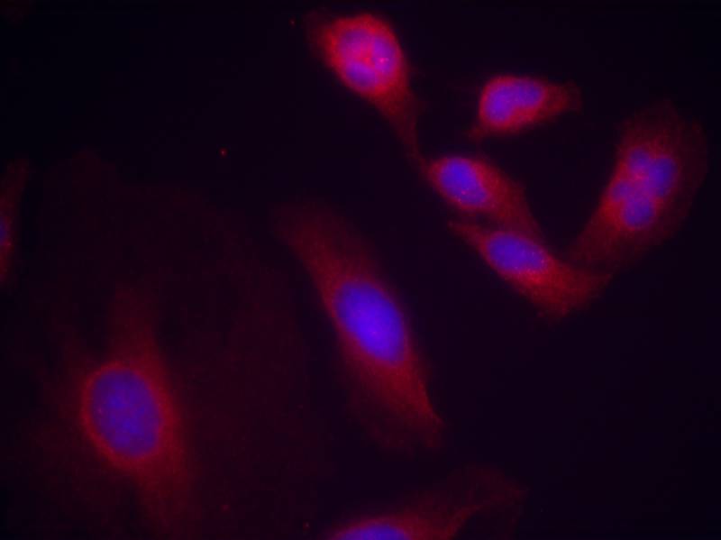RelA/NFkB p65 [p Ser536] Antibody