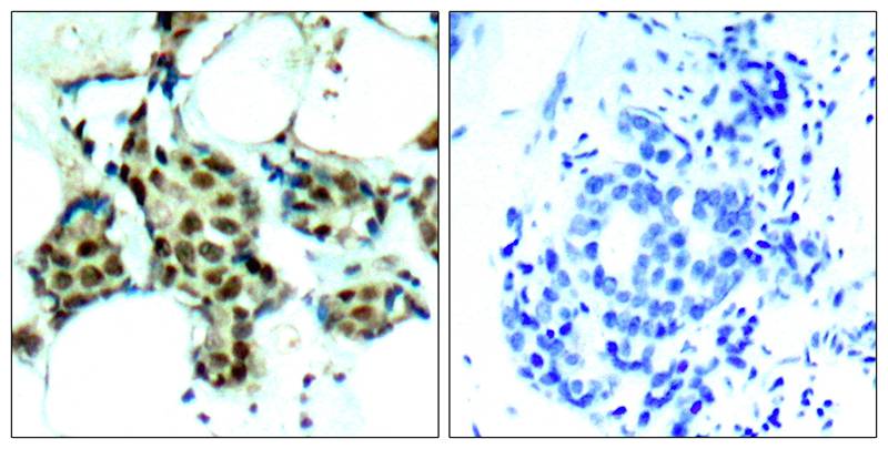 p38 alpha [p Tyr182] Antibody