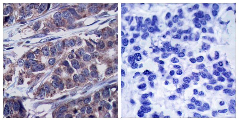 DOK1 [p Tyr362] Antibody - BSA Free