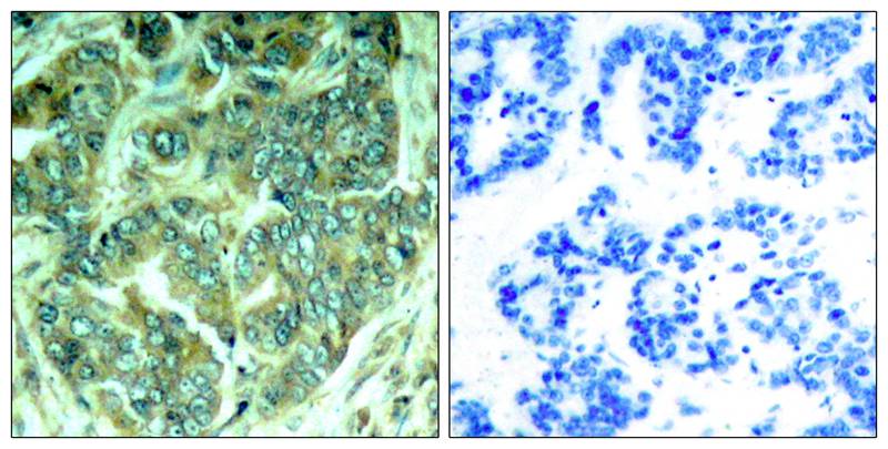 DOK1 [p Tyr398] Antibody - BSA Free
