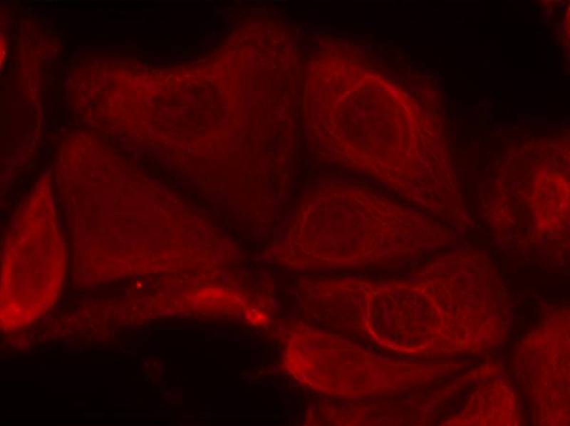 p70 S6 Kinase/S6K [p Ser411] Antibody - BSA Free