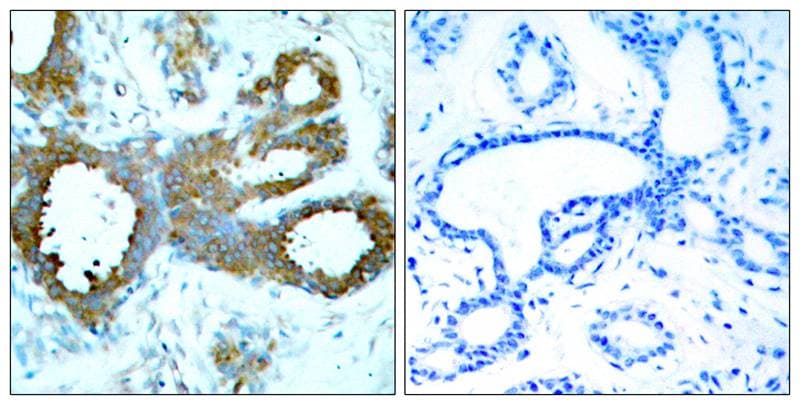 PAK1/2/3 [p Thr423, p Thr402, p Thr421] Antibody - BSA Free