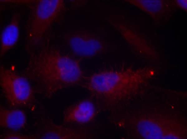 PAK1/2/3 [p Thr423, p Thr402, p Thr421] Antibody - BSA Free