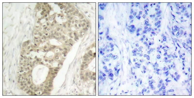 PKC delta [p Ser645] Antibody - BSA Free