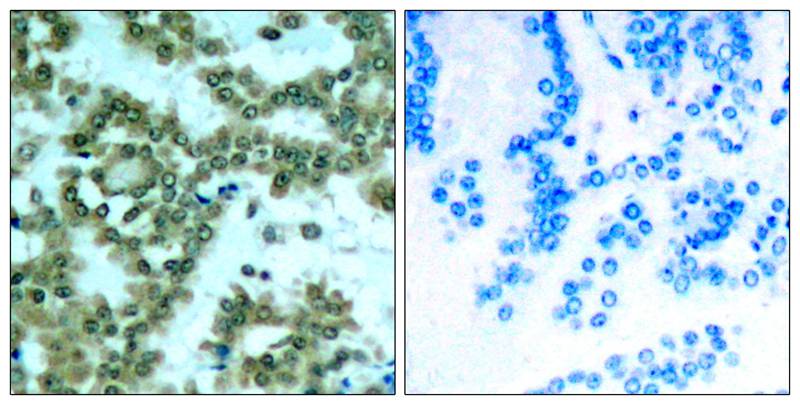 PKC theta [p Ser676] Antibody - BSA Free