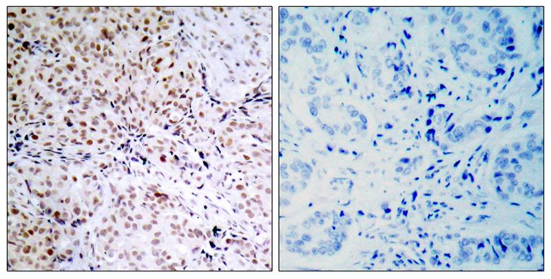 RB1 [p Ser795] Antibody - BSA Free