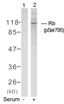 RB1 [p Ser795] Antibody - BSA Free
