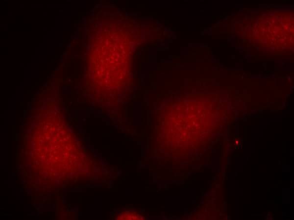 RB1 [p Ser795] Antibody - BSA Free