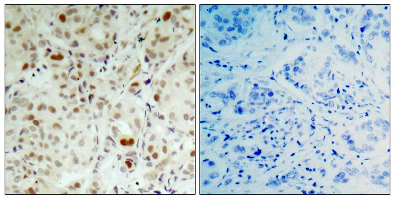 RB1 [p Ser807] Antibody - BSA Free