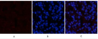 STAT3 [p Tyr705] Antibody