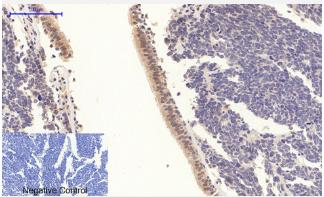 STAT3 [p Tyr705] Antibody