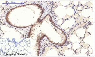 STAT3 [p Tyr705] Antibody