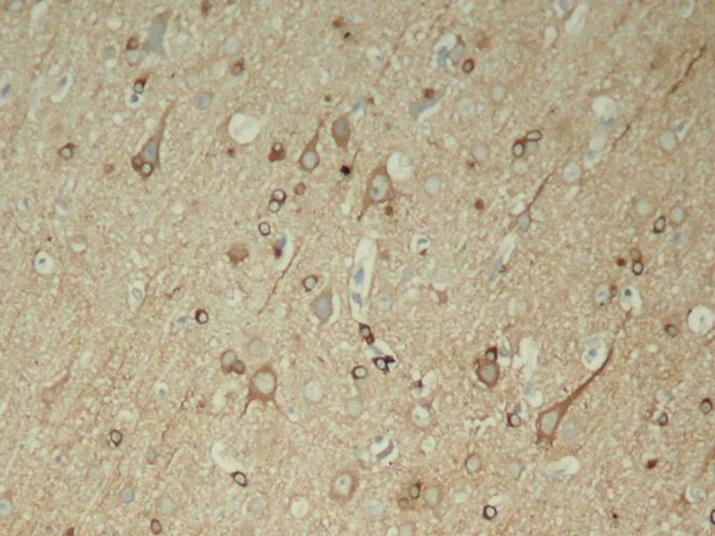 Tau [p Ser396] Antibody - BSA Free