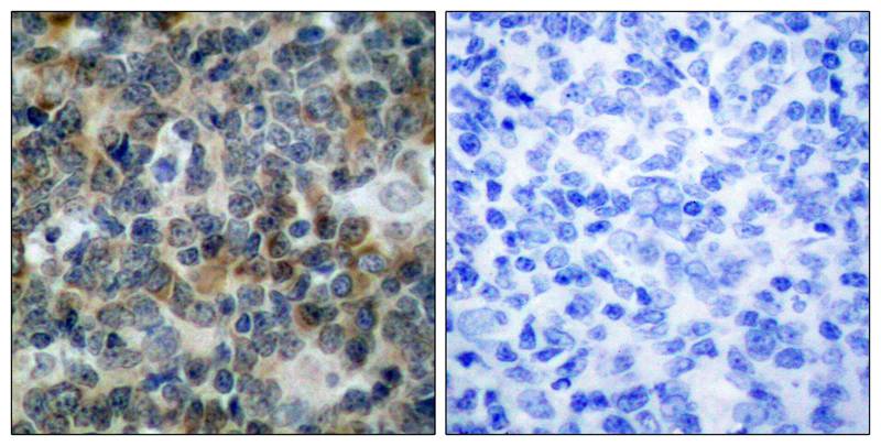 VASP [p Ser238] Antibody - BSA Free
