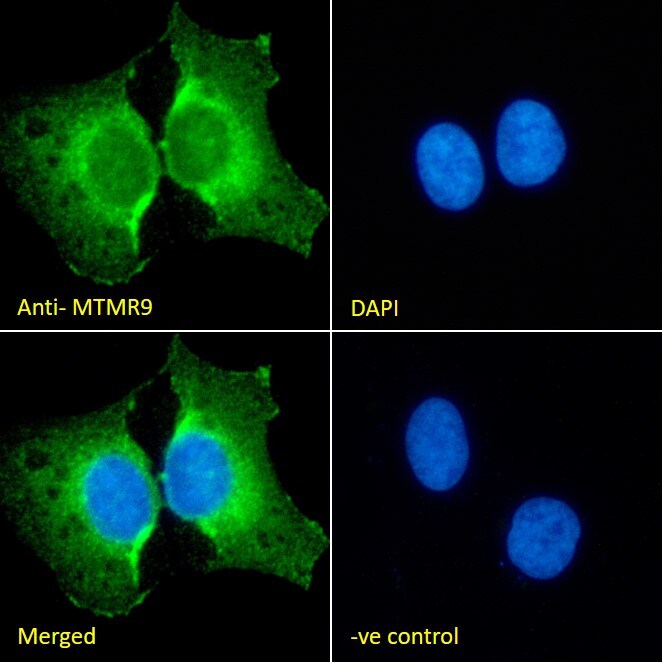 MTMR9 Antibody