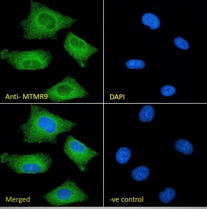 MTMR9 Antibody