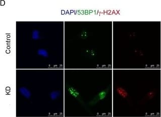 53BP1 Antibody - BSA Free