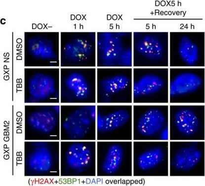 53BP1 Antibody - BSA Free