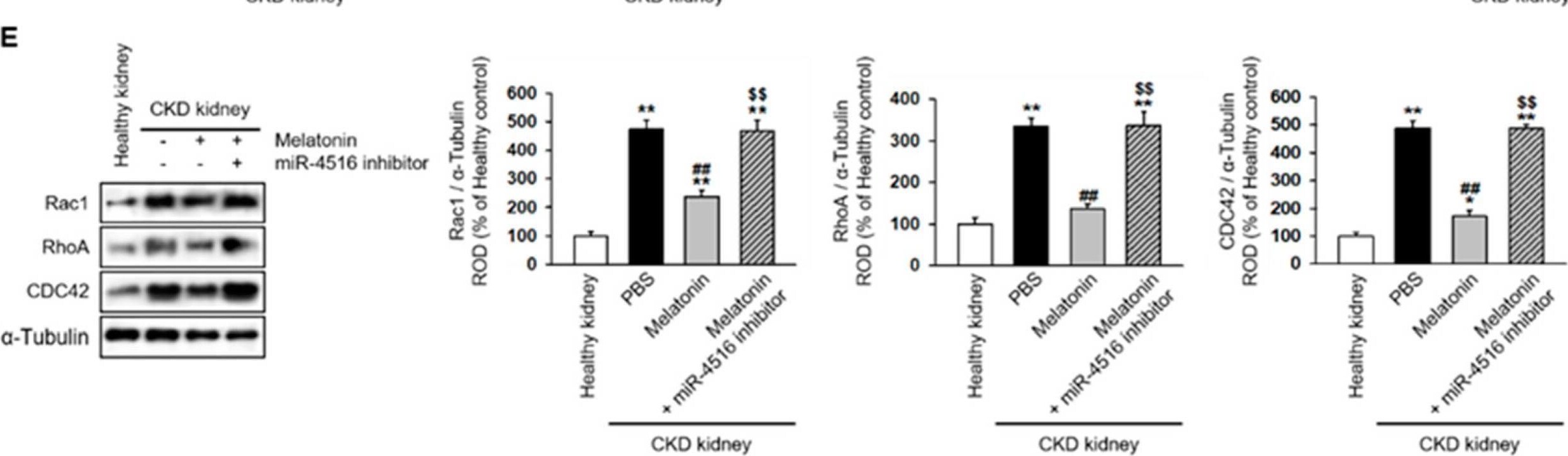 RhoA Antibody