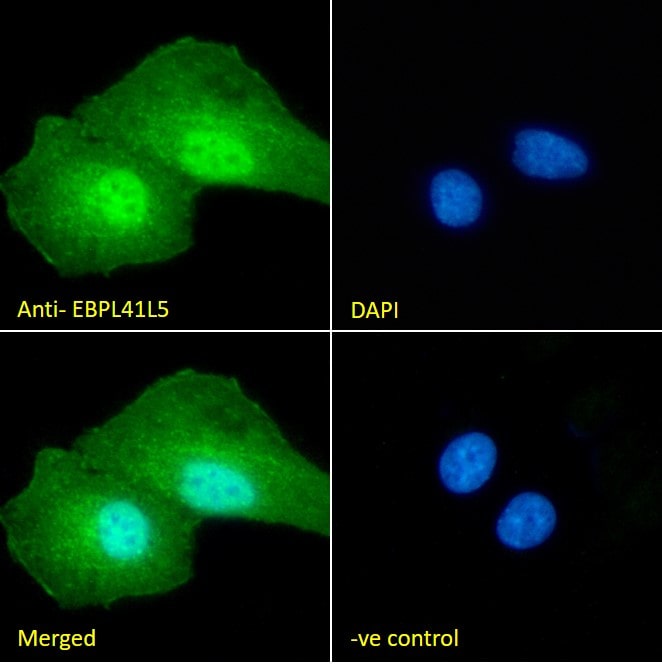 EPB41L5 Antibody