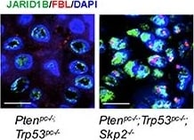 Lysine (K)-specific Demethylase 5B/KDM5B/JARID1B Antibody - BSA Free