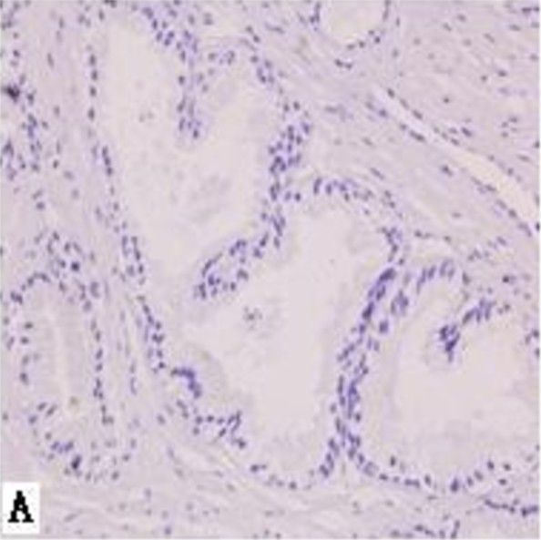 AG-2/AGR2 Antibody - BSA Free