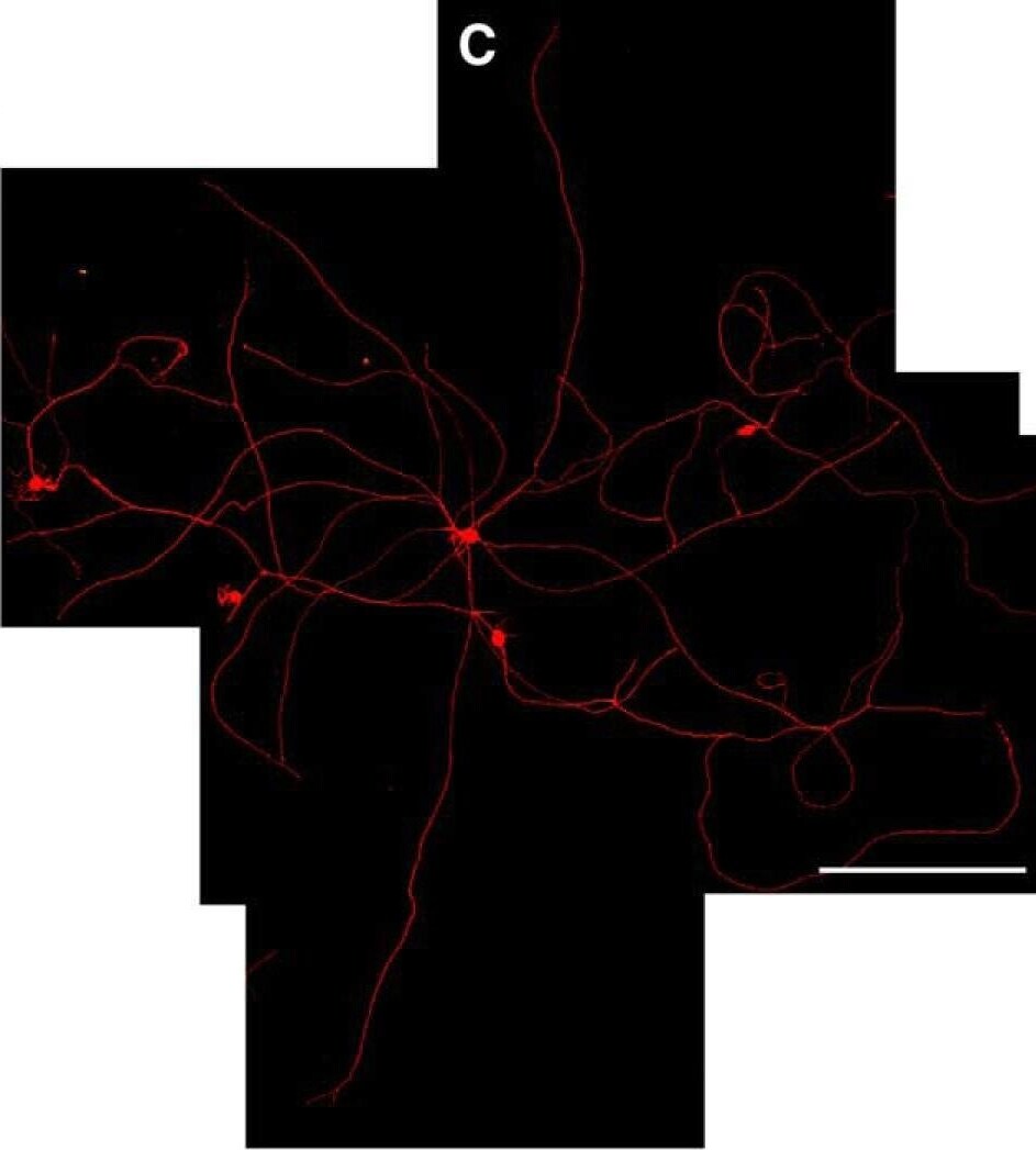 Alkaline Phosphatase/ALPP Antibody (8B6) - BSA Free