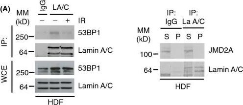 Lysine (K)-specific Demethylase 4A/KDM4A/JMJD2A Antibody