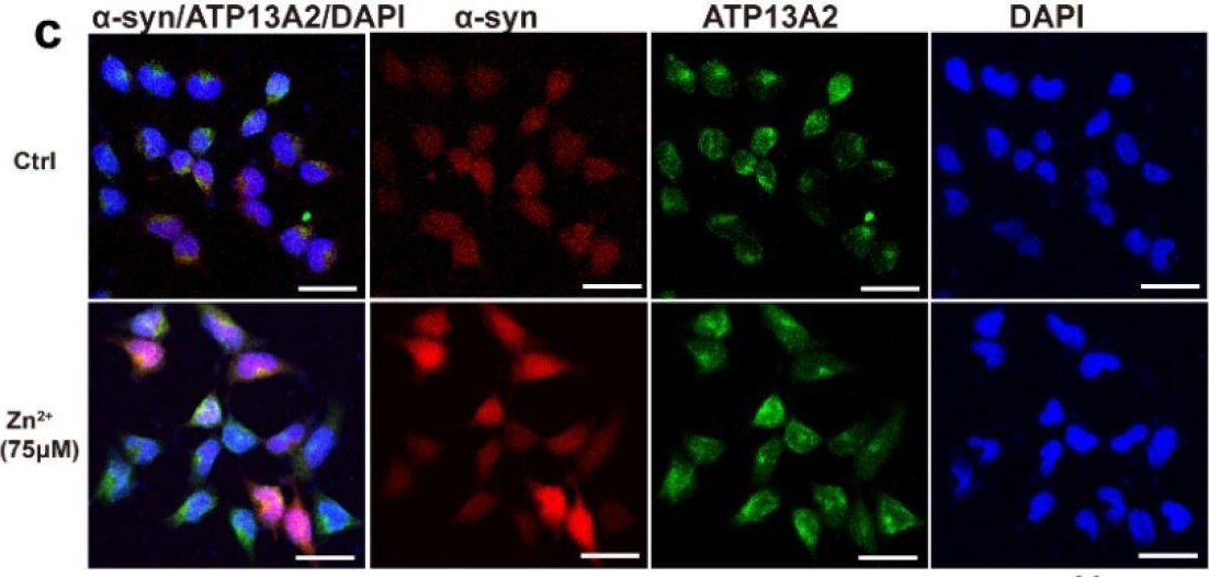 ATP13A2 Antibody - BSA Free