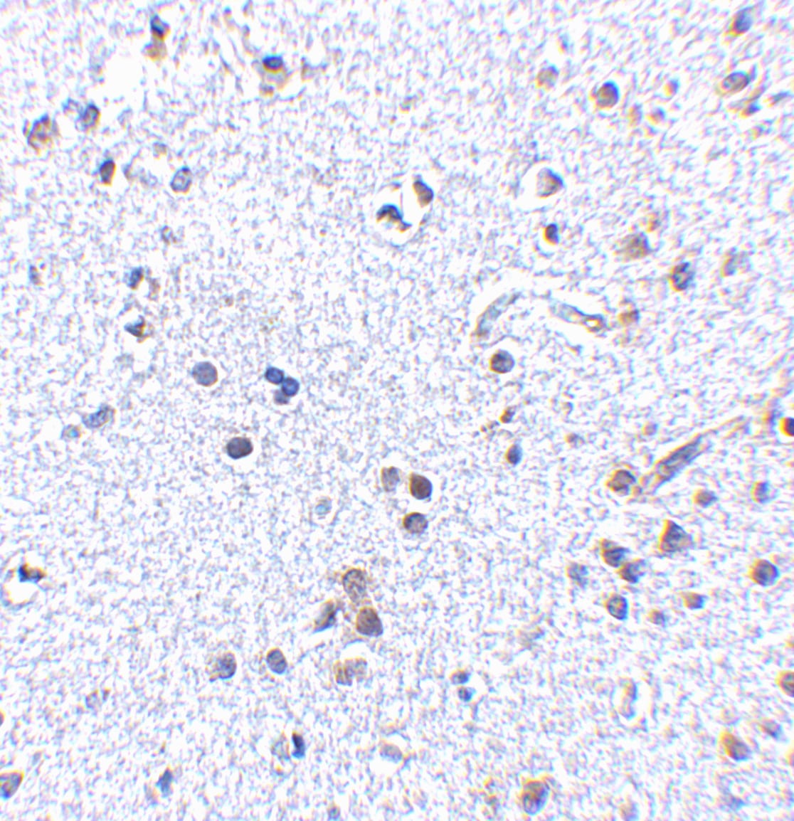 TSLP Antibody - BSA Free
