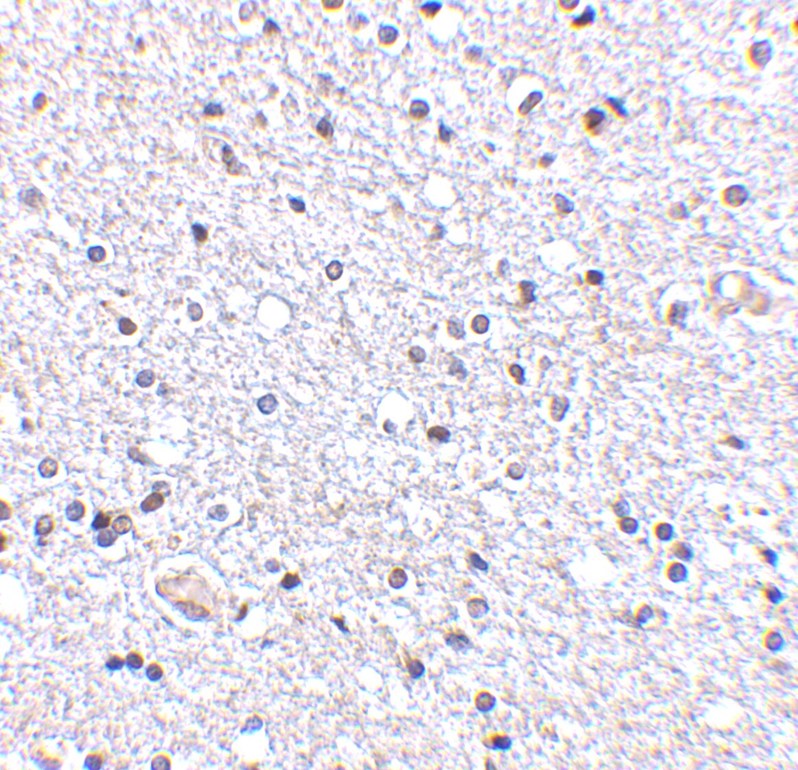 TSLP Antibody - BSA Free