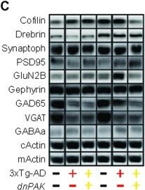VIAAT/SLC32A1/VGAT Antibody - BSA Free