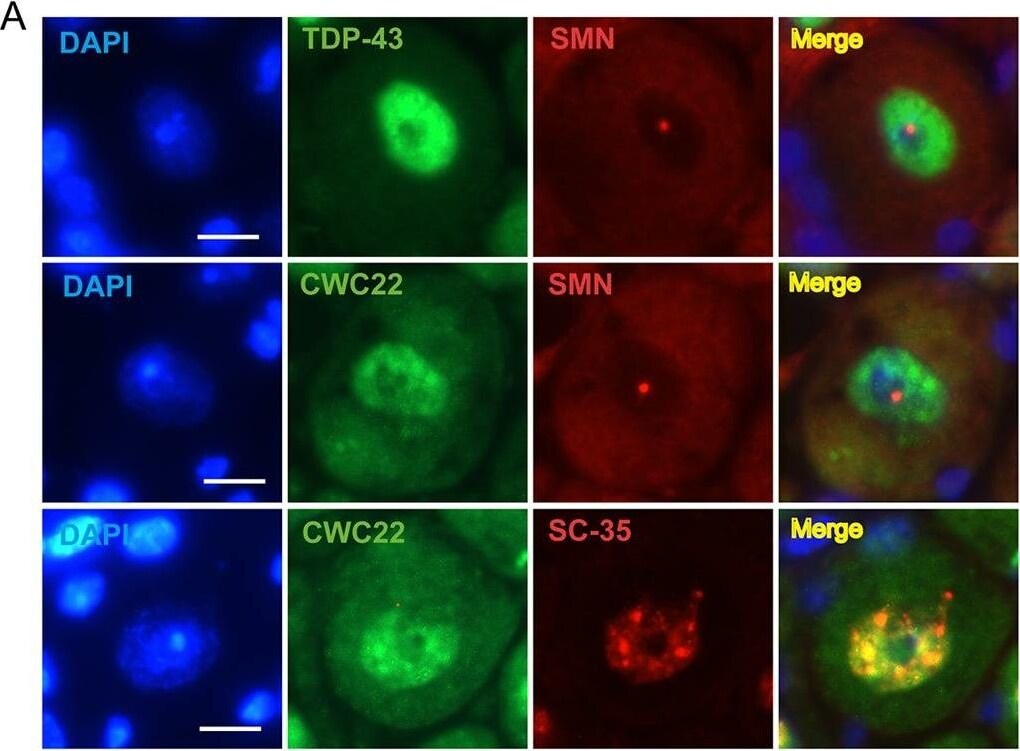 TDP-43/TARDBP Antibody - BSA Free
