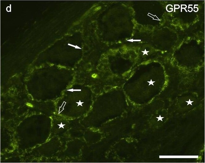GPR55 Antibody - BSA Free
