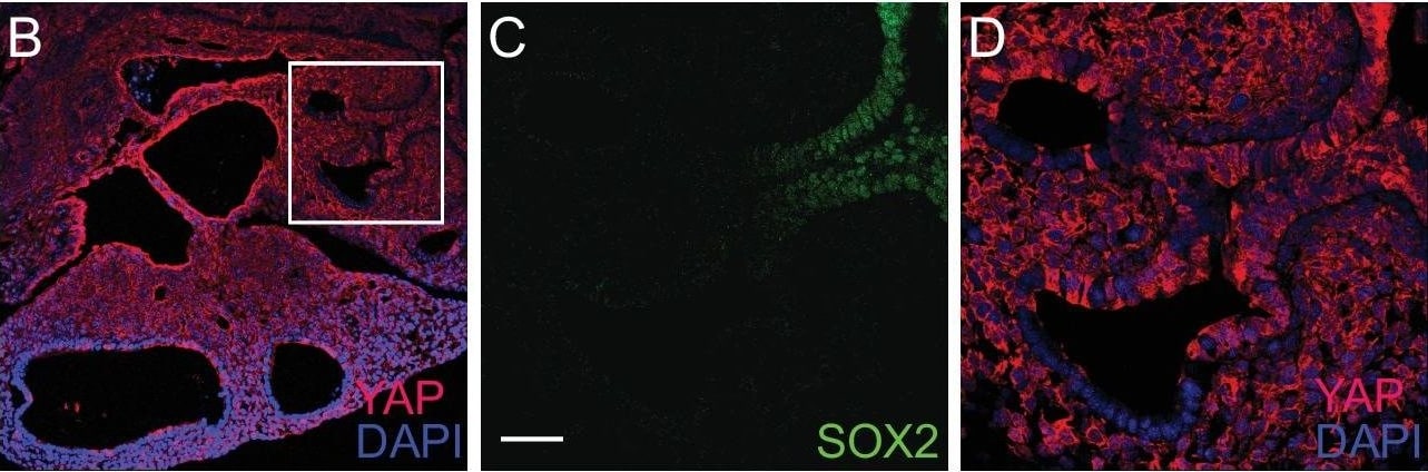 YAP1 Antibody - BSA Free