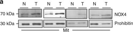 Nox4 Antibody - BSA Free